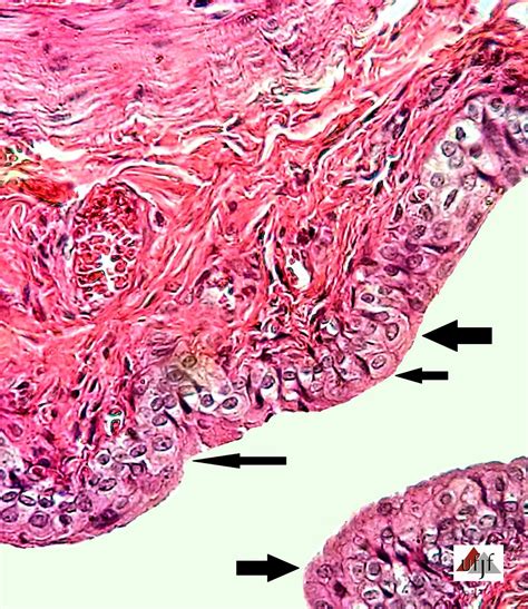 Histology Atlas Online®: Bladder - Slide 26