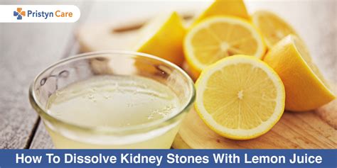 How To Dissolve Kidney Stones With Lemon Juice? - Pristyn Care