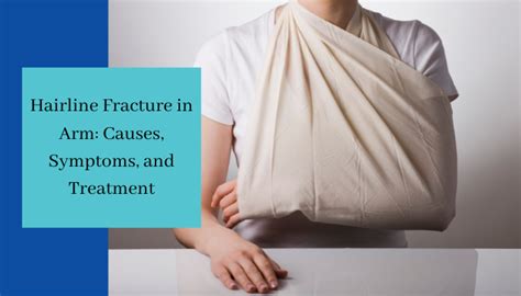 Hairline Fracture In Arm: Causes, Symptoms, And Treatment