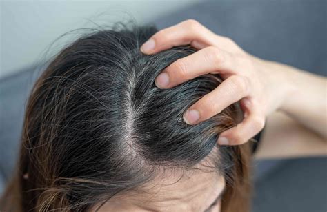 Itchy Scalp: Causes, Treatment, and Prevention