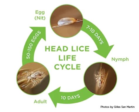 What is Lice? Get the Facts | Lice Clinics of America - McKinney, Texas