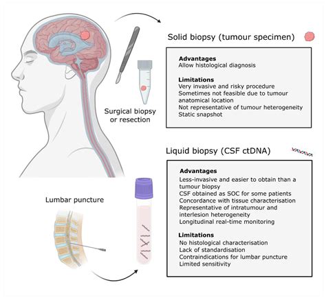 Cancers | Free Full-Text | ctDNA-Based Liquid Biopsy of Cerebrospinal Fluid in Brain Cancer