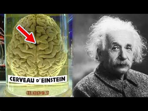 VOICI COMMENT LE CERVEAU D’EINSTEIN ÉTAIT DIFFÉRENT