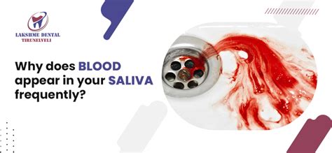 Why Does Blood Appear in Your Saliva Frequently?