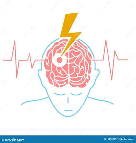 Concept of the Disease is a Stroke Stock Illustration - Illustration of health, poster: 102707952