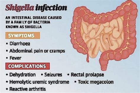 Shigella: Causes, Symptoms, Treatment, and Prevention - THE WORLD SUMMARY