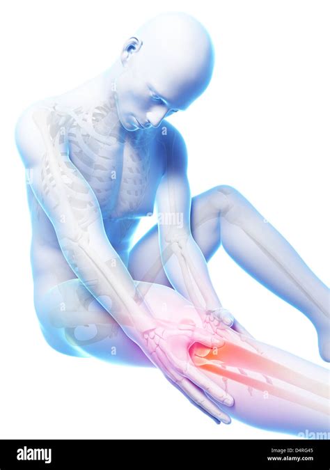 Rayos x de rodilla fotografías e imágenes de alta resolución - Alamy