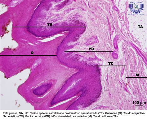 Tecido Epitelial De Revestimento Estratificado Pavimentoso Queratinizado - RETOEDU