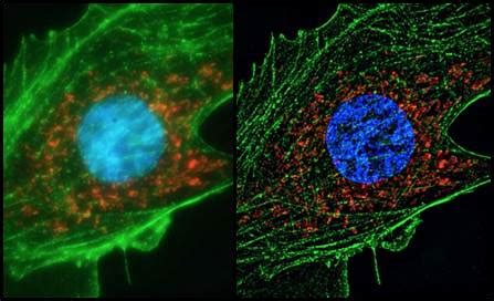 BIOC 053 | Super Resolution Microscopy