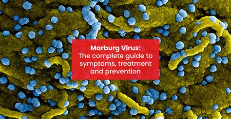 Marburg Virus: The complete guide to symptoms, treatment, and ...