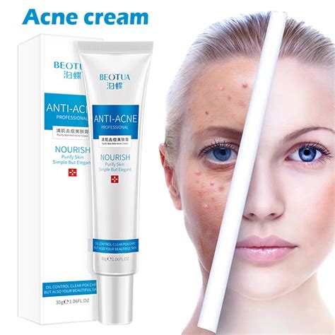 30g Facial Acne Treatment Scar Spots Blemish Marks Removal Cream Face Care SSwell on Aliexpress ...