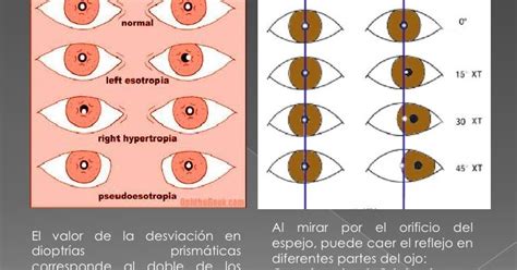 Test empleados en optometria : TEST DE HISCHBERG