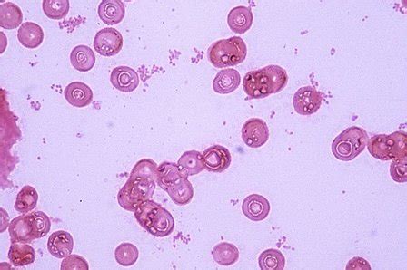 Gram-Negative Coccobacilli - Microbiology learning: The "why"ology of microbial testing