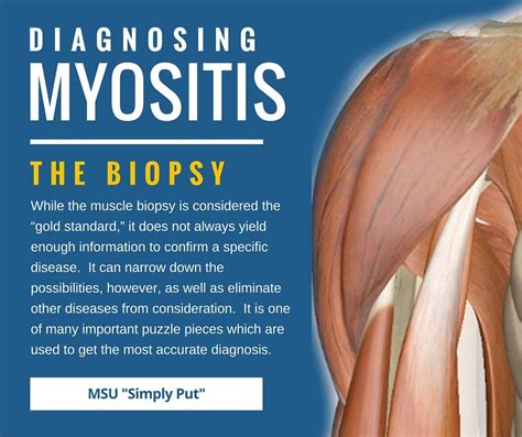 Diagnosing Myositis, updated | Myositis, Dermatomyositis awareness, Polymyositis