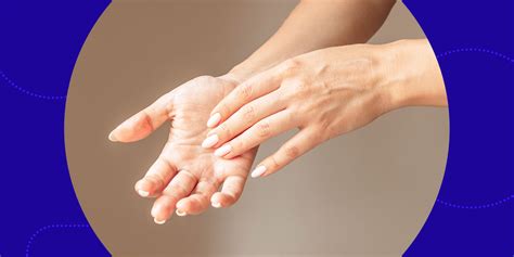 Botox For Hyperhidrosis: A Guide For Medical Professionals