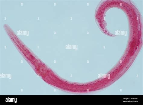 Tapeworm Under A Microscope