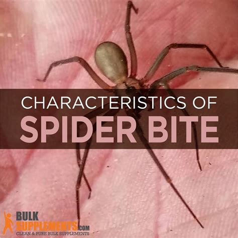 Spider Bite: Characteristics, Causes & Treatment | BulkSupplements.com | Spider bites, Spider ...