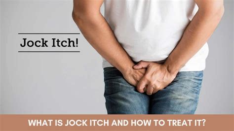 What is Jock Itch and How to Treat It?