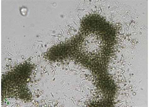 Microcystis aeruginosa - galerie