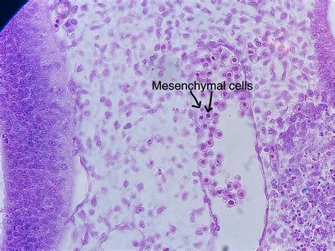 Mesenchyme (Embryological Connective Tissue)