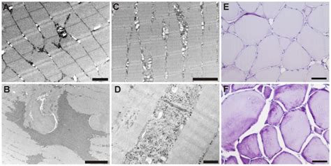 There are some deposits of glycogen granules between the myofibrils ...