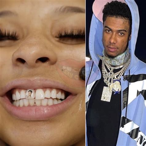 Ground Up Buzz — Chrisean Rock Gets Tooth Implant With BlueFace's...