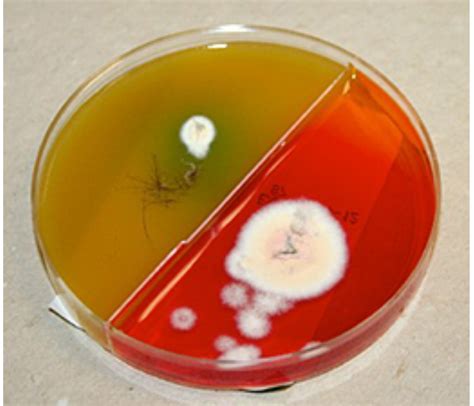 Module 13.2: Common Tests Used to Identify Dermatophytosis – Clinical ...