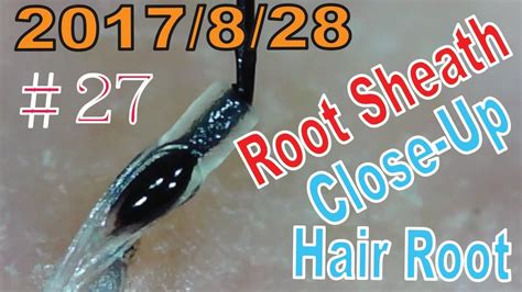 Hair Root / Root Sheath Close Up ＃27【Plucking Root Sheath】 - YouTube