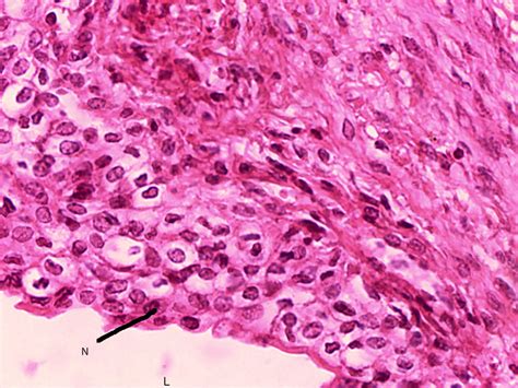 Transitional Epithelial 40x (corrected version) | Histology