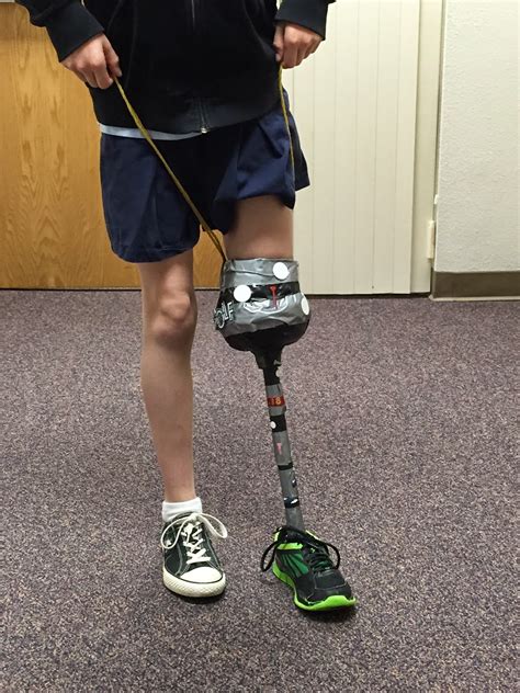 STEM: Building Prosthetic Limbs