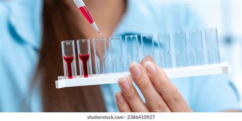 11 X Ray Fluorescence Xrf Images, Stock Photos, 3D objects, & Vectors | Shutterstock