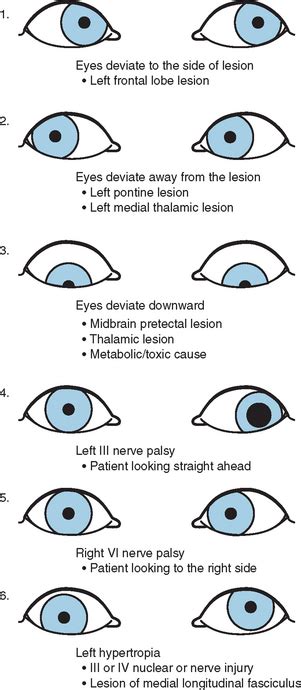 Roving Eye Movements