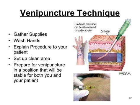 Venipuncture Procedure - SofiaewaRichards