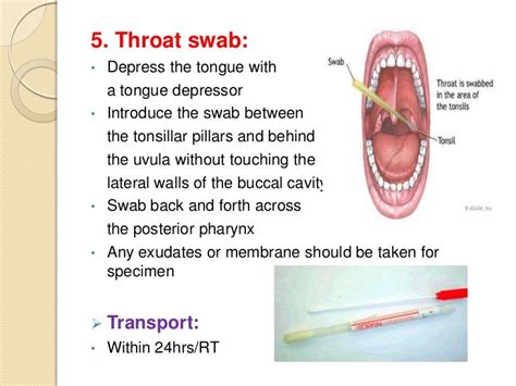 Throat Swab Meaning In Hindi - andre