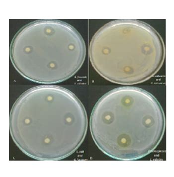 Bacillus clausii Probiotic Strains | Bioflex