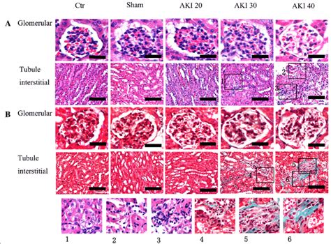 a: HE b: Masson Histology of kidneys on the 28th day after renal ...