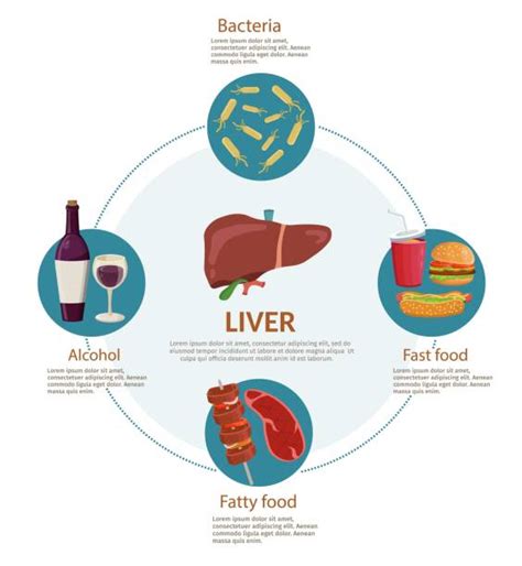 Liver Disease Illustrations, Royalty-Free Vector Graphics & Clip Art ...