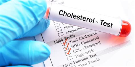 Blood Cholesterol Testing Service - Imaan Healthcare