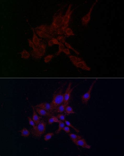 MMP2 Antibody - SAB | Signalway Antibody