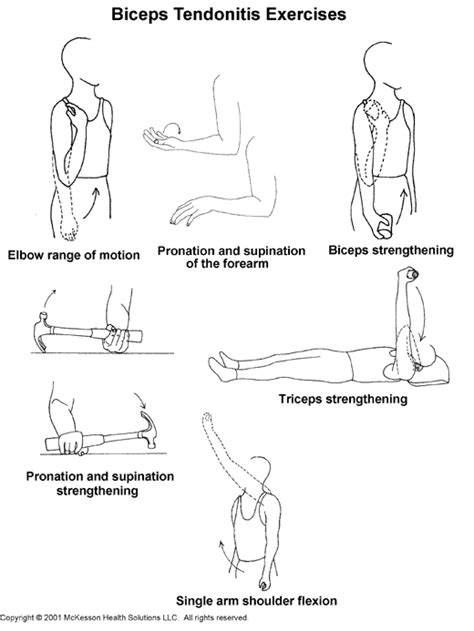 Sports Medicine Advisor 2003.1: Biceps Tendonitis Exercises: Illustration