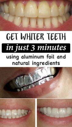 How To Whiten Teeth With Coconut Oil And Baking Soda - Teeth Poster