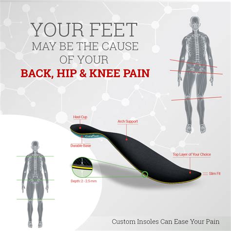 Custom Insoles for Arch Support & Pain Relief - CuraFoot Clinic