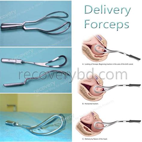 Delivery Forceps; Labor Forceps