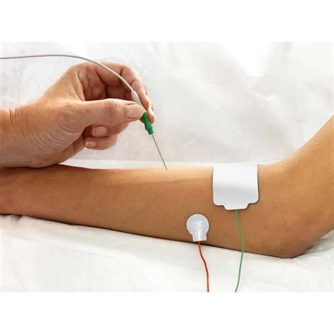 The Cost of EMG Testing: What You Need to Know