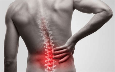 Lower Back Pain Due To Spinal Arthritis Non-Surgical Pain Management Options