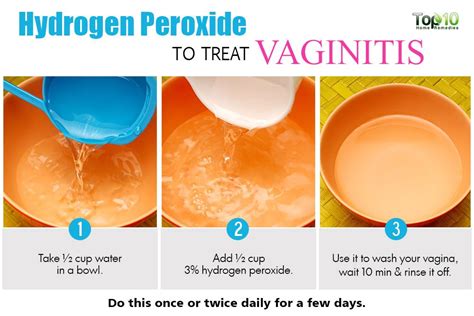 Home Remedies for Vaginitis - Page 2 of 3 | Top 10 Home Remedies