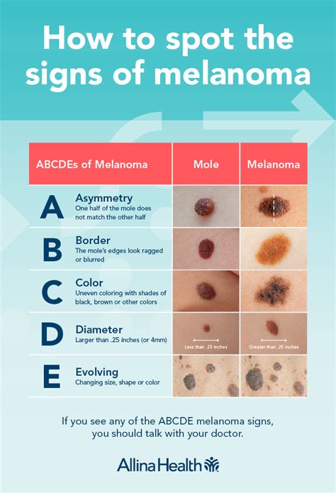 Melanoma Classification | Kaggle