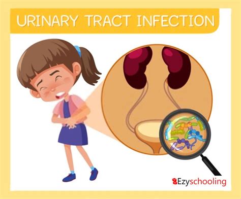 Increasing Risk of Urinary Tract Infection in Kids