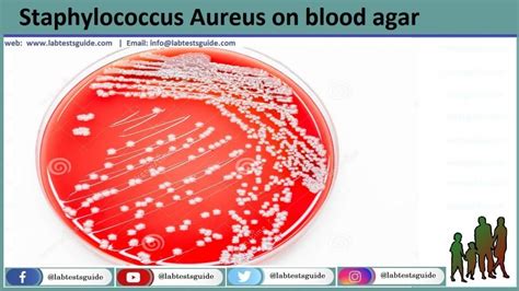 Staphylococcus Aureus: Characteristics, Biochemical Tests and others ...