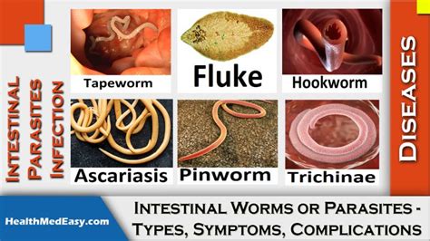 Worms (Intestinal) - Symptoms, Types, Complications - HealthMedEasy.com ...